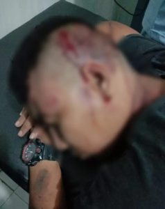 Oknum Anggota Polisi Pelaku Pengroyokan Minta Maaf