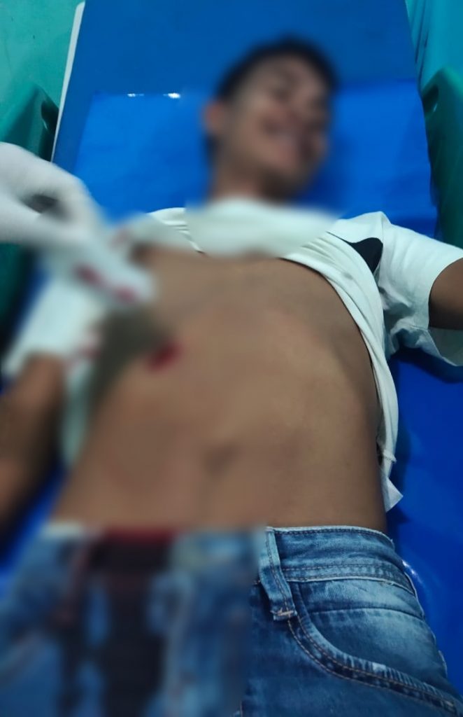 Dikeroyok dan Ditusuk, Pemuda di Tobelo Dilarikan Warga ke RSUD